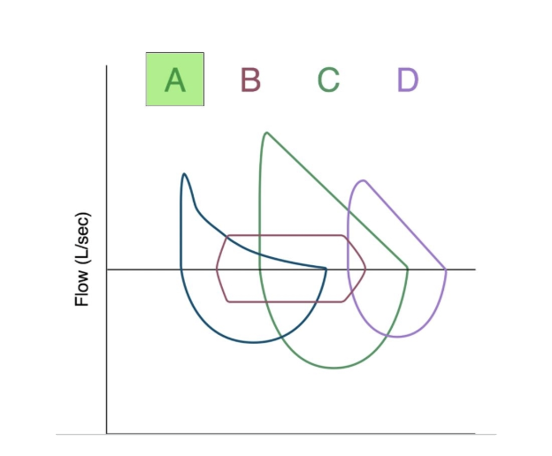 <p>A= obstructive, like COPD</p><p>B. Fixed tracheal lesion</p><p>C. Normal</p><p>D. Restrictive</p>