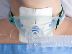 <p>Tracheostomy</p>