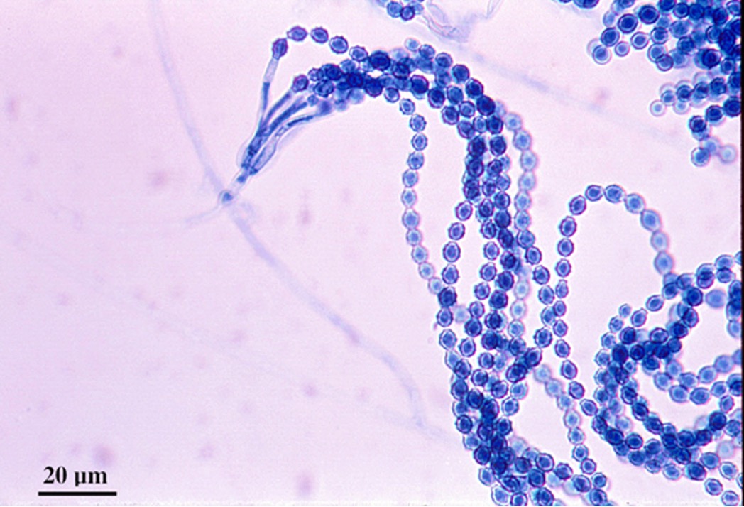term image