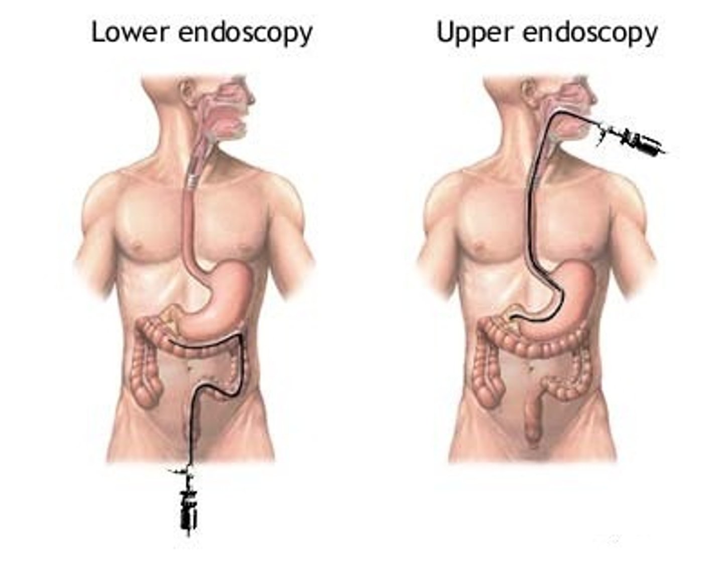 <p>gastrointestinal endoscopy</p>