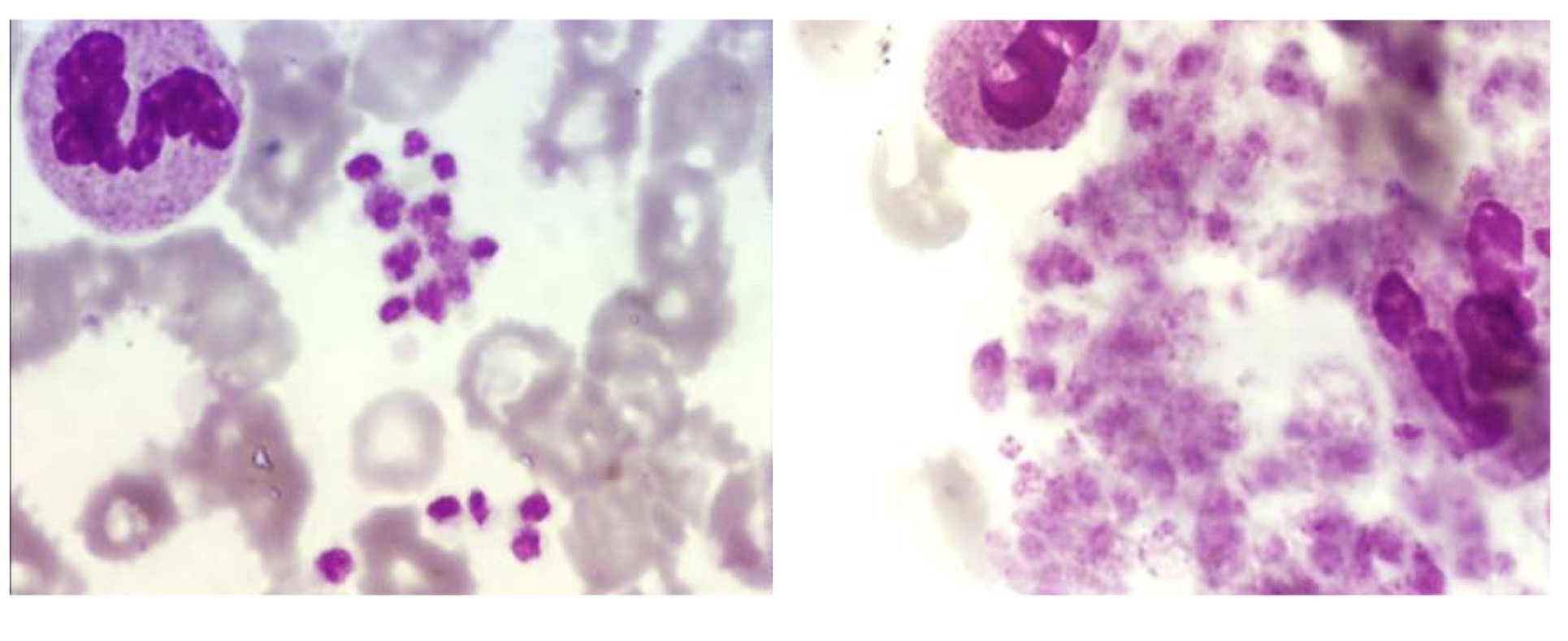 <p>Name this abnormality, and how can we tell?</p>