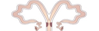 <p>Whose uterus looks like this?</p>