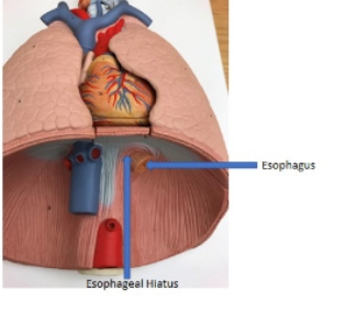 <p>esophagus, esophageal hiatus</p>