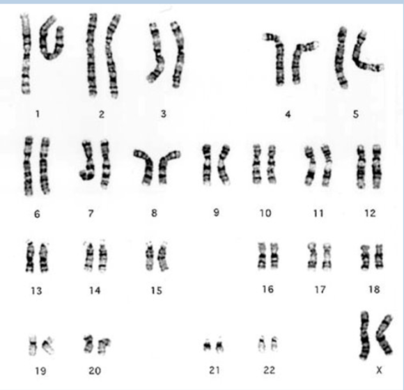 <p>an image of an individuals complete set of chromosomes</p>