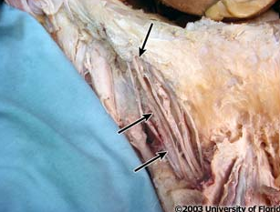 <p>what artery is being indicated to in the image (context: image is taken of spermatic cord)</p>