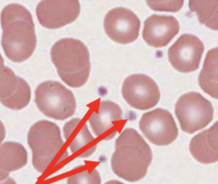 <p>These fragments of megakaryocytes appear as small purple bits scattered among the red blood cells. They are important in the process of hemostasis (blood clotting). A normal count is 250,000 - 500,000 per cubic millimeter of blood.</p>