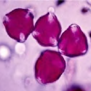 <p>Type of pollen? </p>