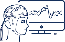 <p>Event-Related Potentials (ERPs)</p>