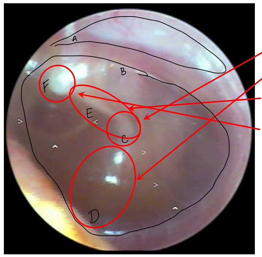 <p>E</p>