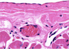 <p>Identify</p>