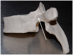 <p>Name this specific part of the thoracic vertebra.</p>