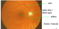 <p>carries all info out of the eye</p><p>axons of the ganglia cells (leaving the eye) </p><p>optic disc: part of fundus where the bundle of ganglion cells exits the eye</p><p>no photoreceptors = blindspot</p>