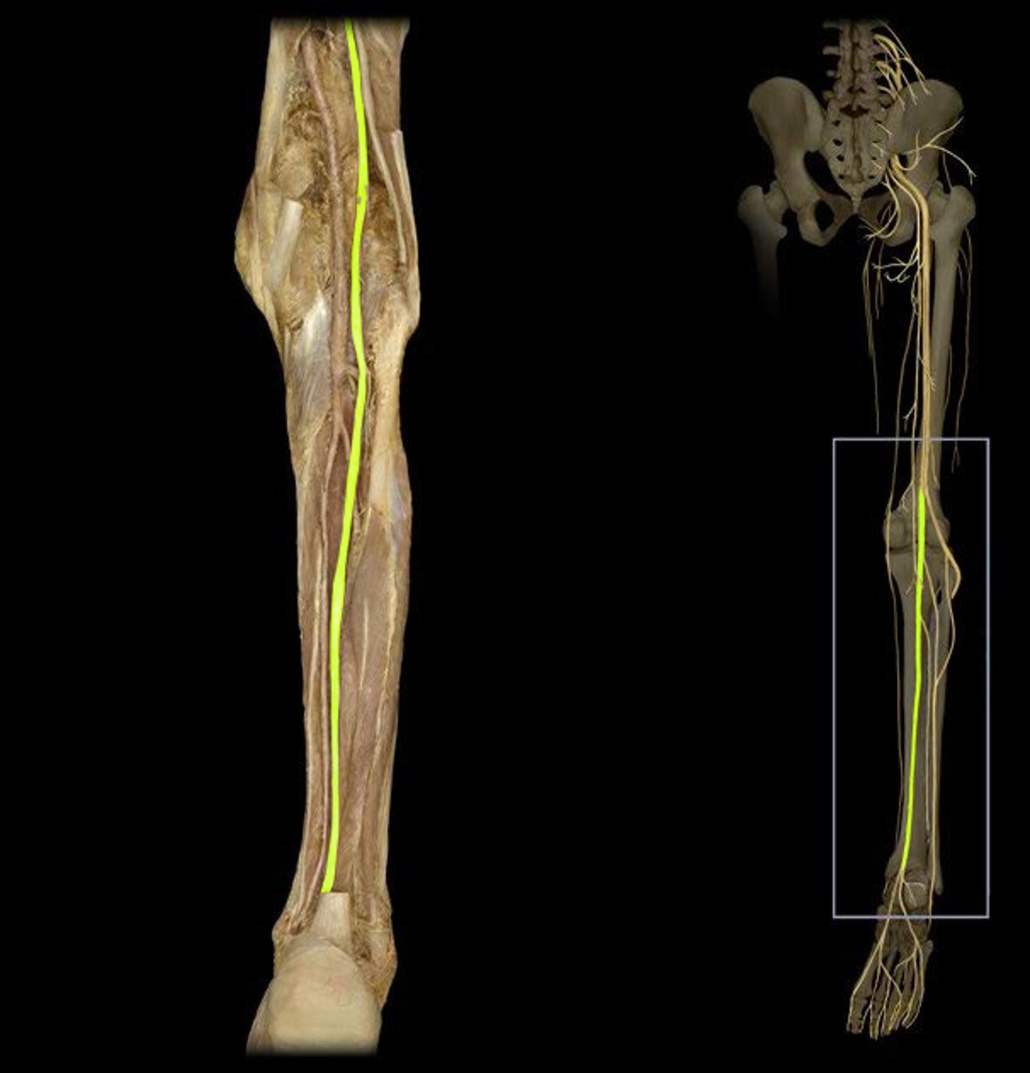 <p>-L4-S3</p><p>-Sacral Plexus</p><p>-runs through posterior lower limb towards ankle</p><p>-innervates posterior lower limb, sole of foot</p>