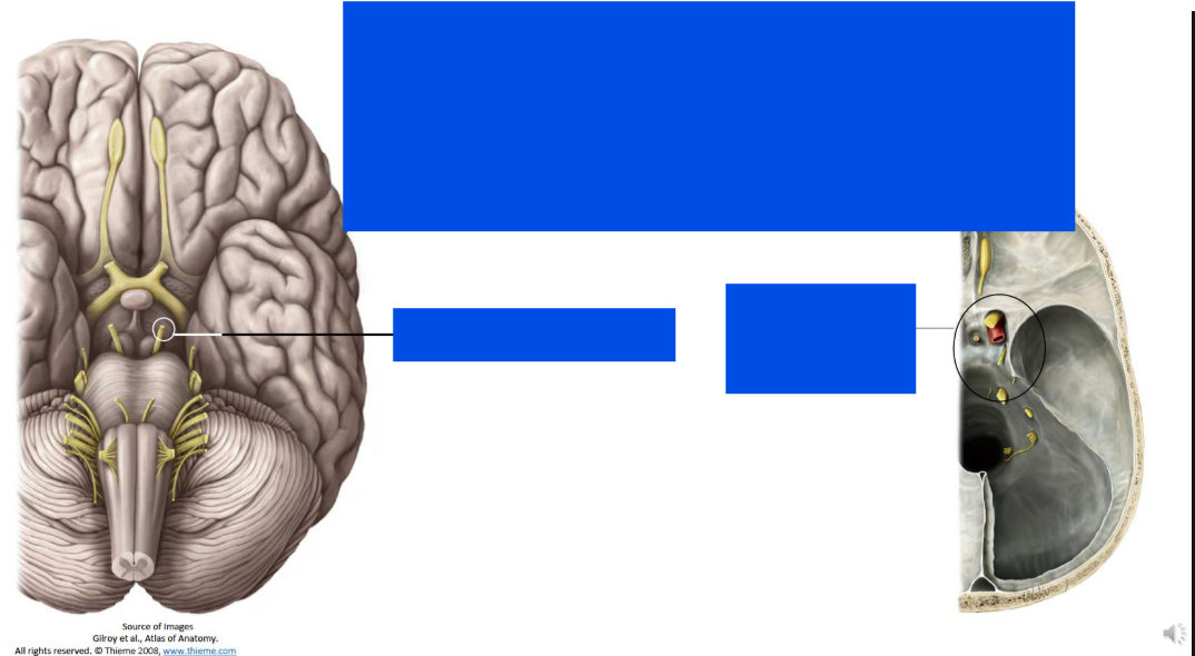 <p>Describe the occulomotor nerve</p>
