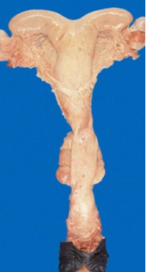 <p>Whose uterus is this?</p>