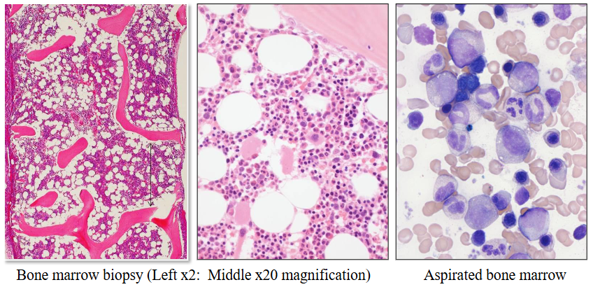<p>What does Bone Marrow look like under the microscope</p>