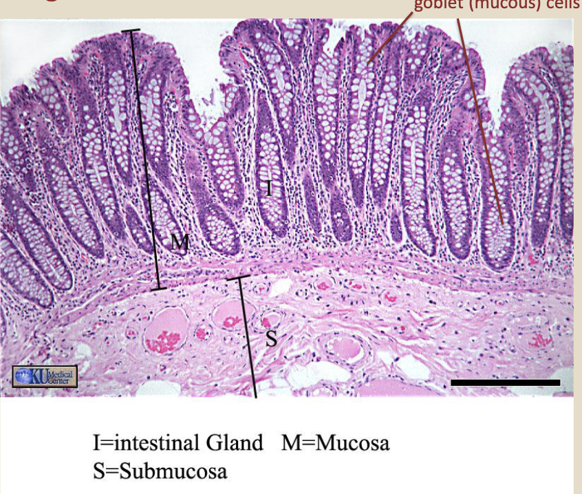 <p>so many goblet cells</p>