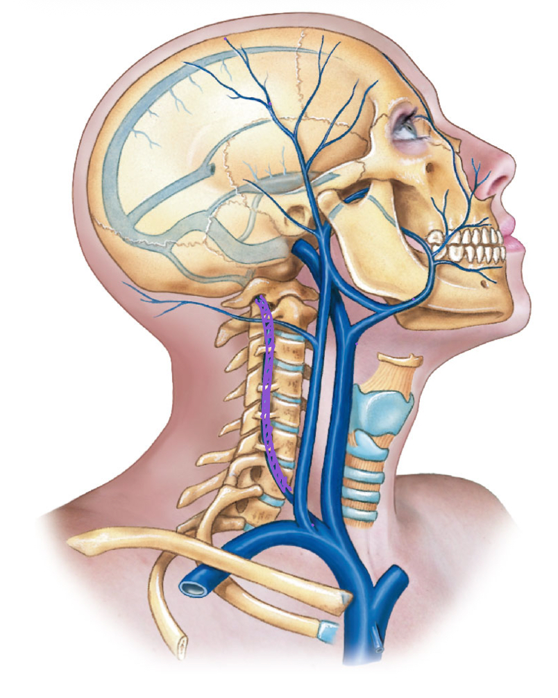<p>diagram </p>
