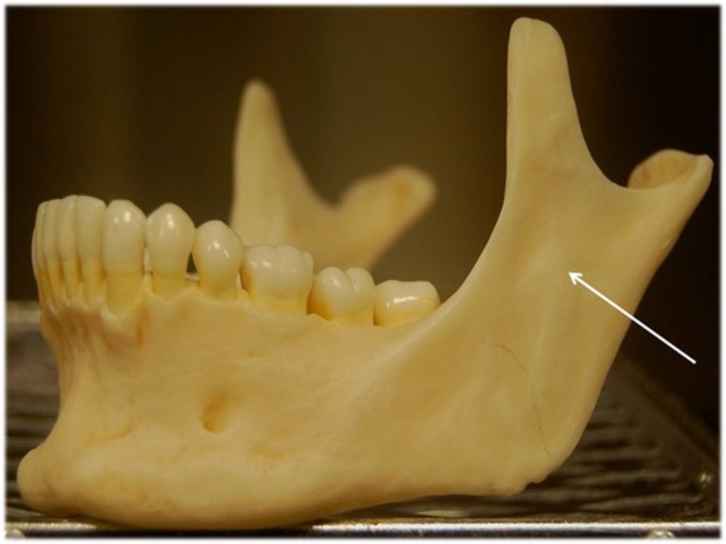 <p>ID part of bone indicated by arrow</p>