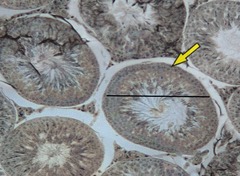 <p>Identify these circular structures.</p>