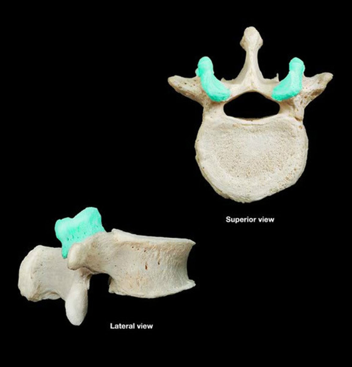 <p>A flat or nearly flat surface on a bone; where two vertebrae articulate; superior side</p>