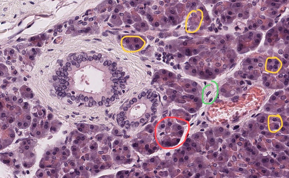 <p>What is circled in red?</p>