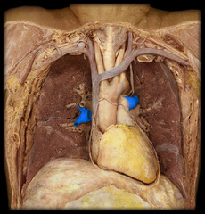 <p>identify the structure</p>