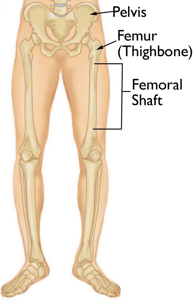 <p>In the upper part of the thigh - like the femur bone </p>