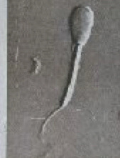 <p>What is this? Normal or abnormal sperm?</p>