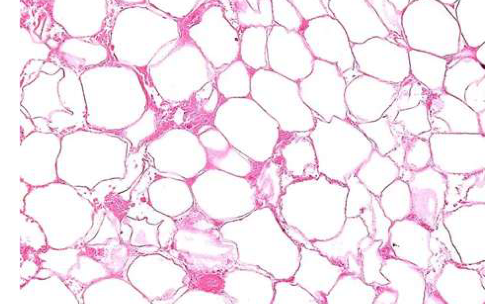 <p>outlines of dead fat cells w no nuclei </p>