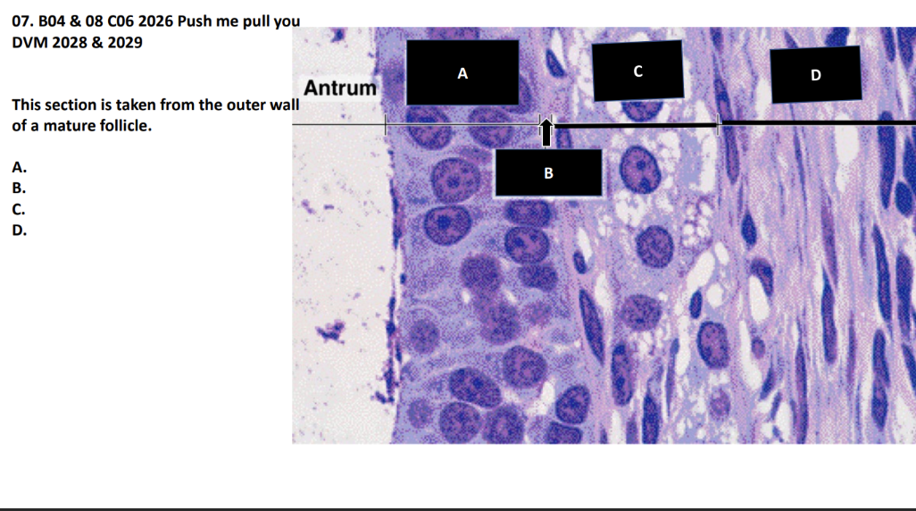 <p>This section is taken from the outer wall </p><p>of a mature follicle.</p><p>A.</p><p>B.</p><p>C.</p><p>D.</p>