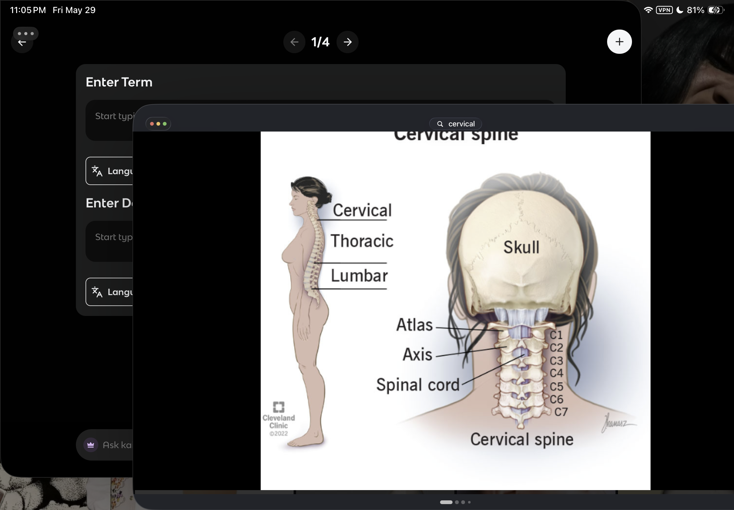 <p>Highest upper most vertebrae</p>