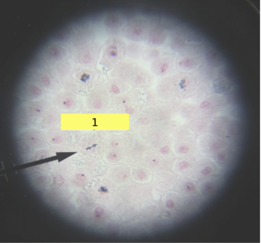 <p>what stage of mitosis?</p>