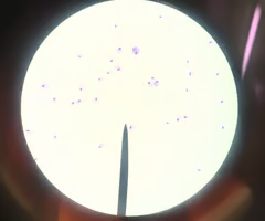 <p>• hydrogenosomes (reduced mitochondria) </p><p>• Trichomonas vaginalis</p>