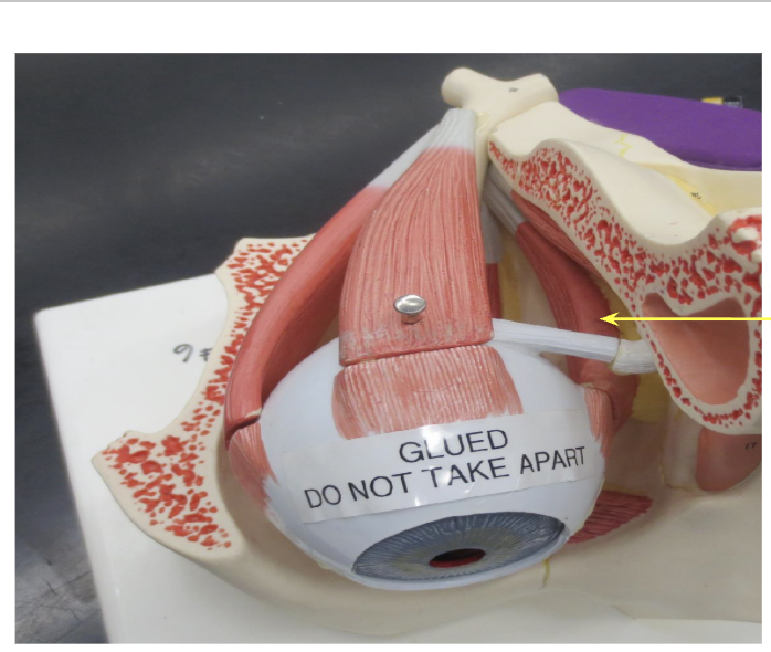 <p>What Muscle is this?</p>