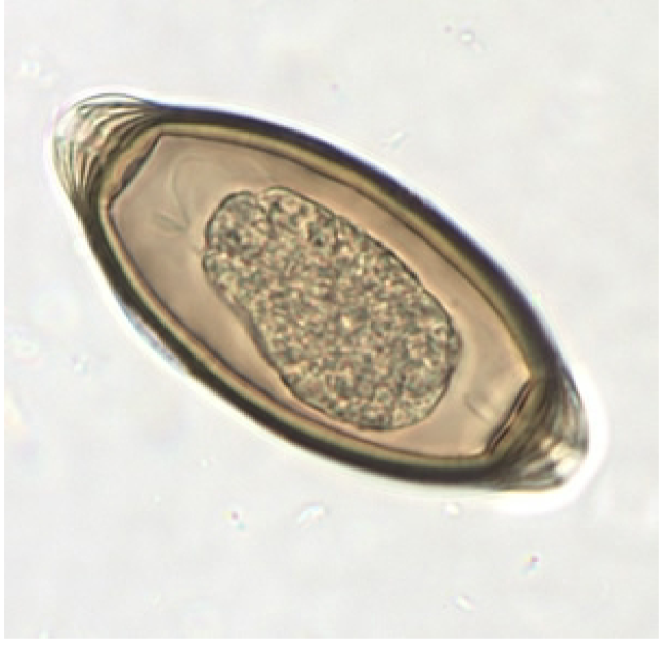<p>-Egg</p><ul><li><p>Thick walls</p></li><li><p>Bilateral polar plugs</p></li></ul><p></p>