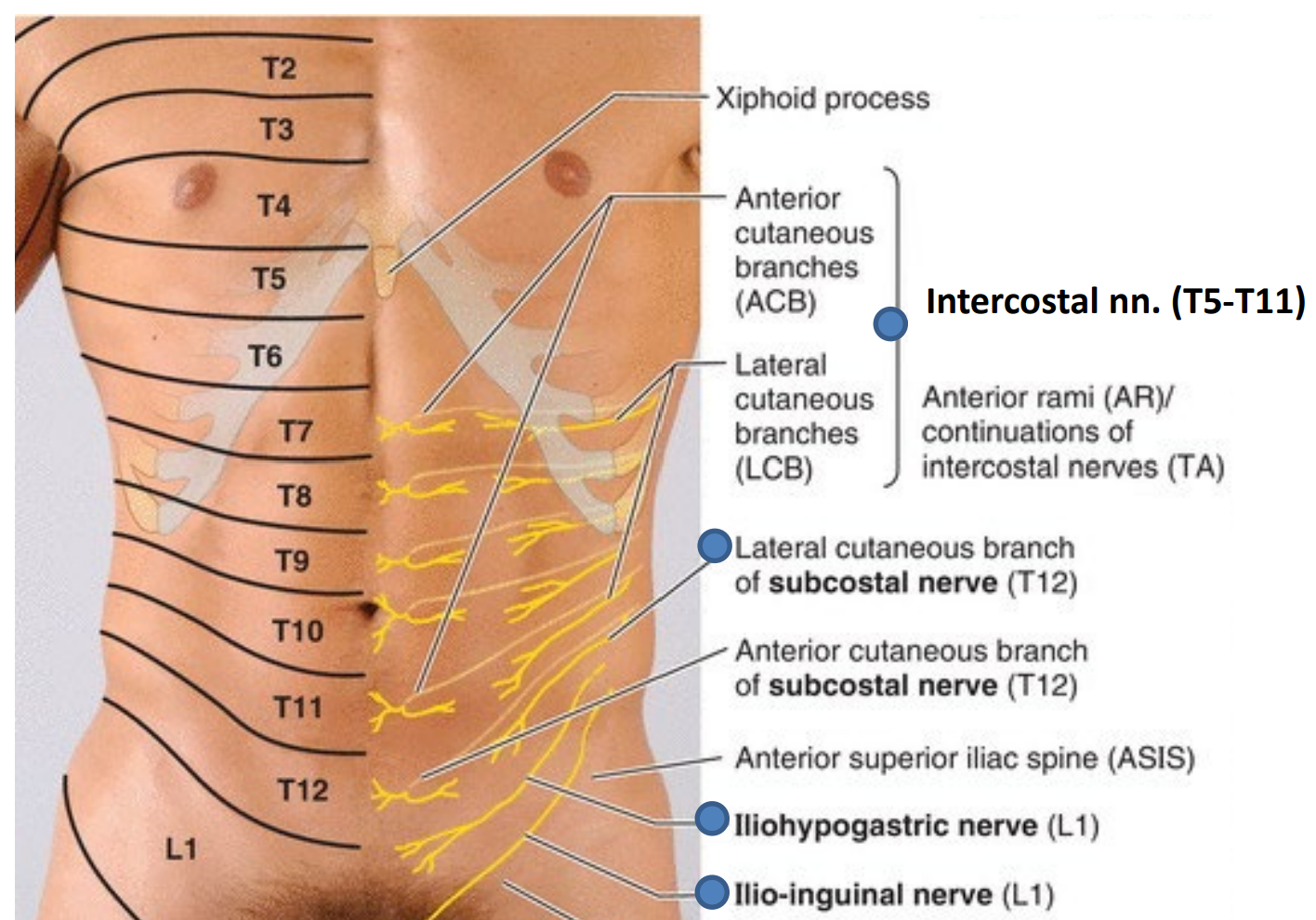 <ul><li><p>On <span style="color: yellow;"><strong>T12</strong></span></p></li><li><p>All Four Anterolateral Abdominal Wall muscles are innervated by this</p></li></ul><ul><li><p>Innervates <span style="color: rgb(31, 235, 240);"><strong>Quadratus lumborum</strong></span></p></li></ul><p></p>