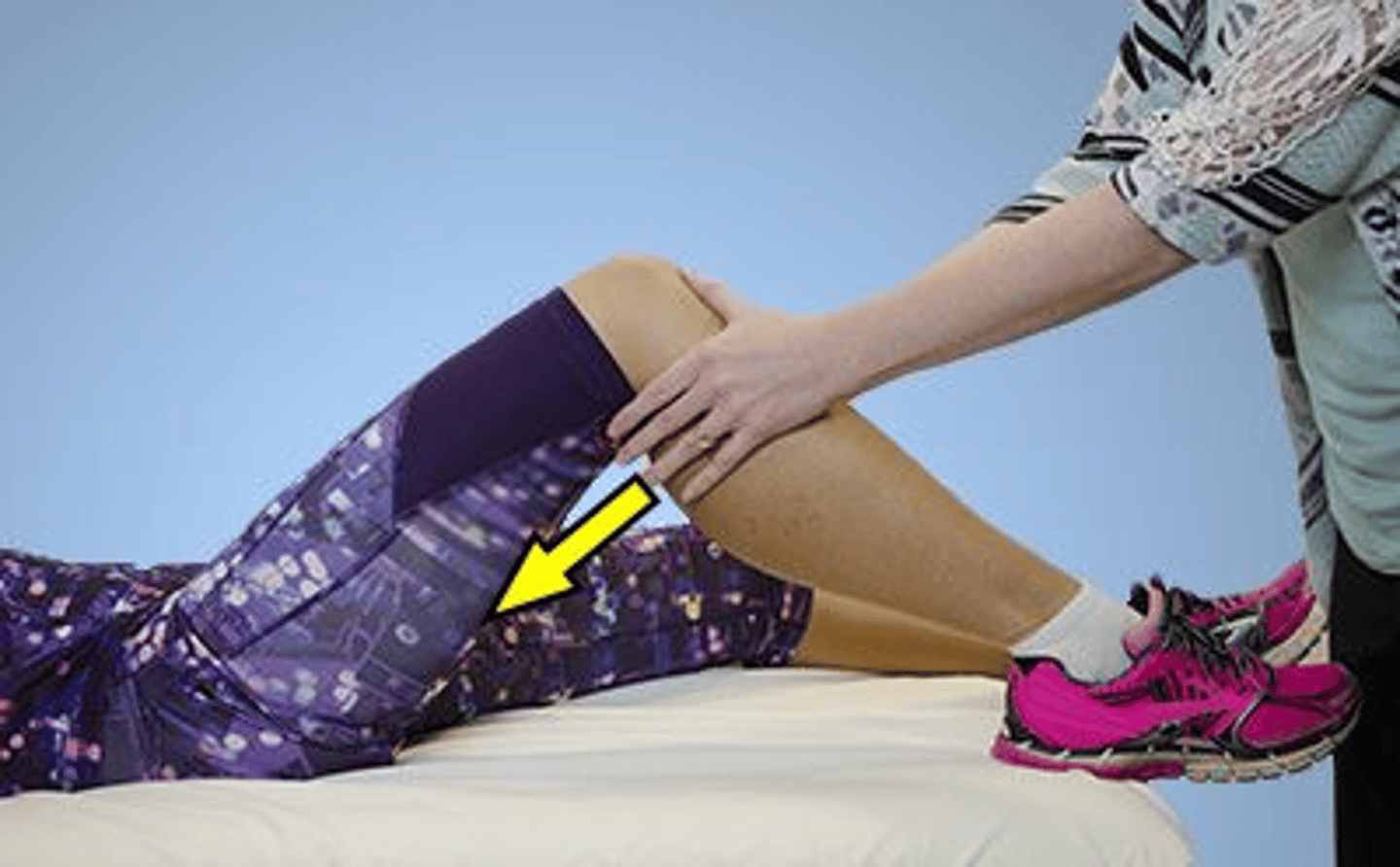 <p>3,3</p><p>1. The Posterior Drawer Test at 90° of knee flexion has been shown to be the most sensitive test for clinical assessment of the posterior cruciate ligament. Extreme hyperextension of the knee can cause anterior cruciate ligament injury, not posterior cruciate ligament injury.</p><p>2. The Posterior Drawer Test at 90° of knee flexion has been shown to be the most sensitive test for clinical assessment of the posterior cruciate ligament. An activity that results in a very strong quadriceps contraction that coincides with sudden knee flexion, such as landing from a jump, can cause a patellar tendon rupture, not posterior cruciate ligament injury.</p><p>3. The Posterior Drawer Test at 90° of knee flexion has been shown to be the most sensitive test for clinical assessment of the posterior cruciate ligament. Rupture of the posterior cruciate ligament is usually caused by a direct blow to the proximal tibia, a fall on the knee with the foot in a plantar flexed position, or hyperflexion of the knee.</p><p>4. The Posterior Drawer Test at 90° of knee flexion has been shown to be the most sensitive test for clinical assessment of the posterior cruciate ligament. A direct impact to the outside of the knee can cause an anterior cruciate ligament injury, not posterior cruciate ligament injury.</p>