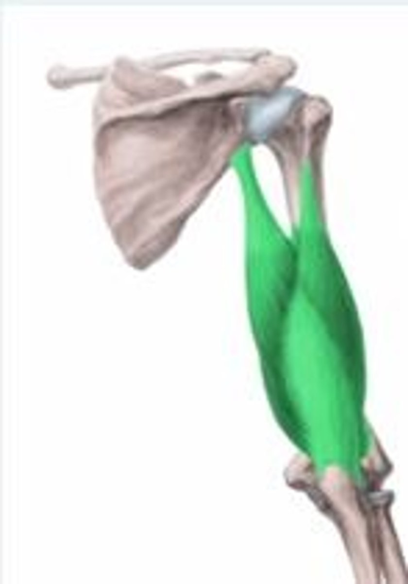<p>The structures highlighted in green in the following illustration form parts of which muscle?</p>