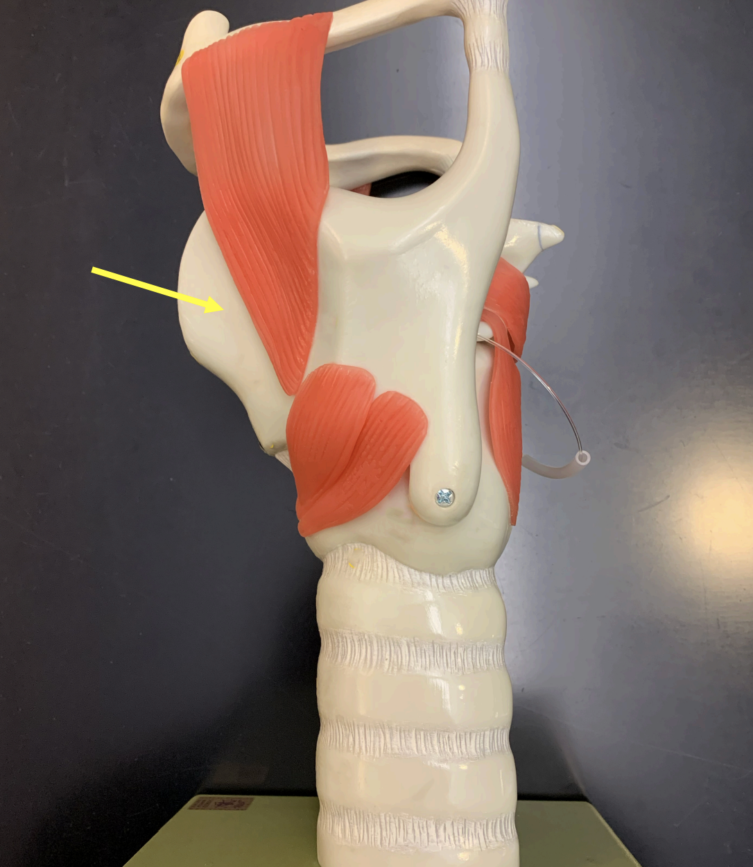 <p>this cartilage contains the laryngeal prominence (adam’s apple)</p>