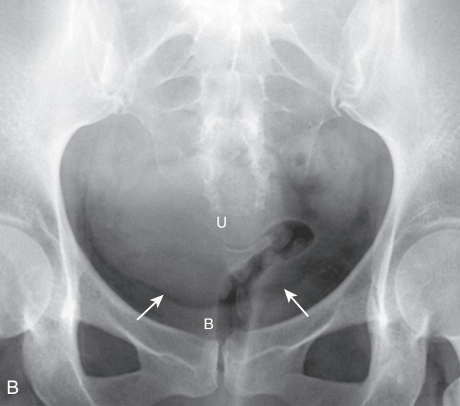 <p>diagnosis</p>