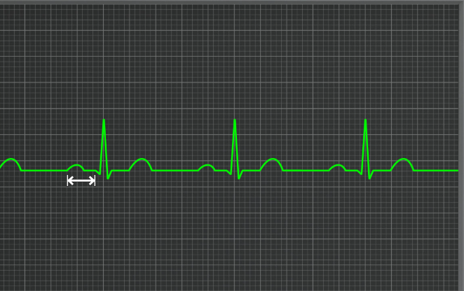 <p>What interval is this </p>