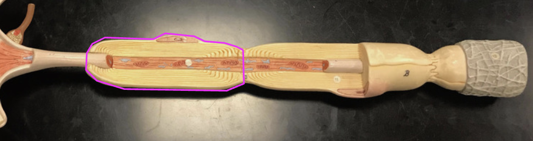 <p>What is being outlined in purple?</p>