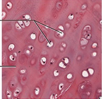 <p>Identify the type of cartilage</p>