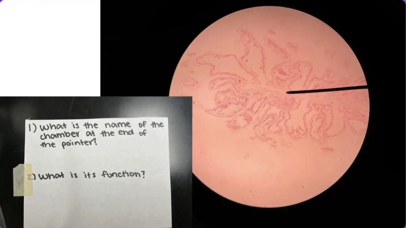 <p>What is the function of the chamber at the end of the pointer?</p>