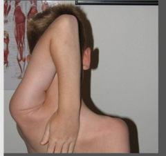 <p>reaching over the head to touch opposite scapula</p>
