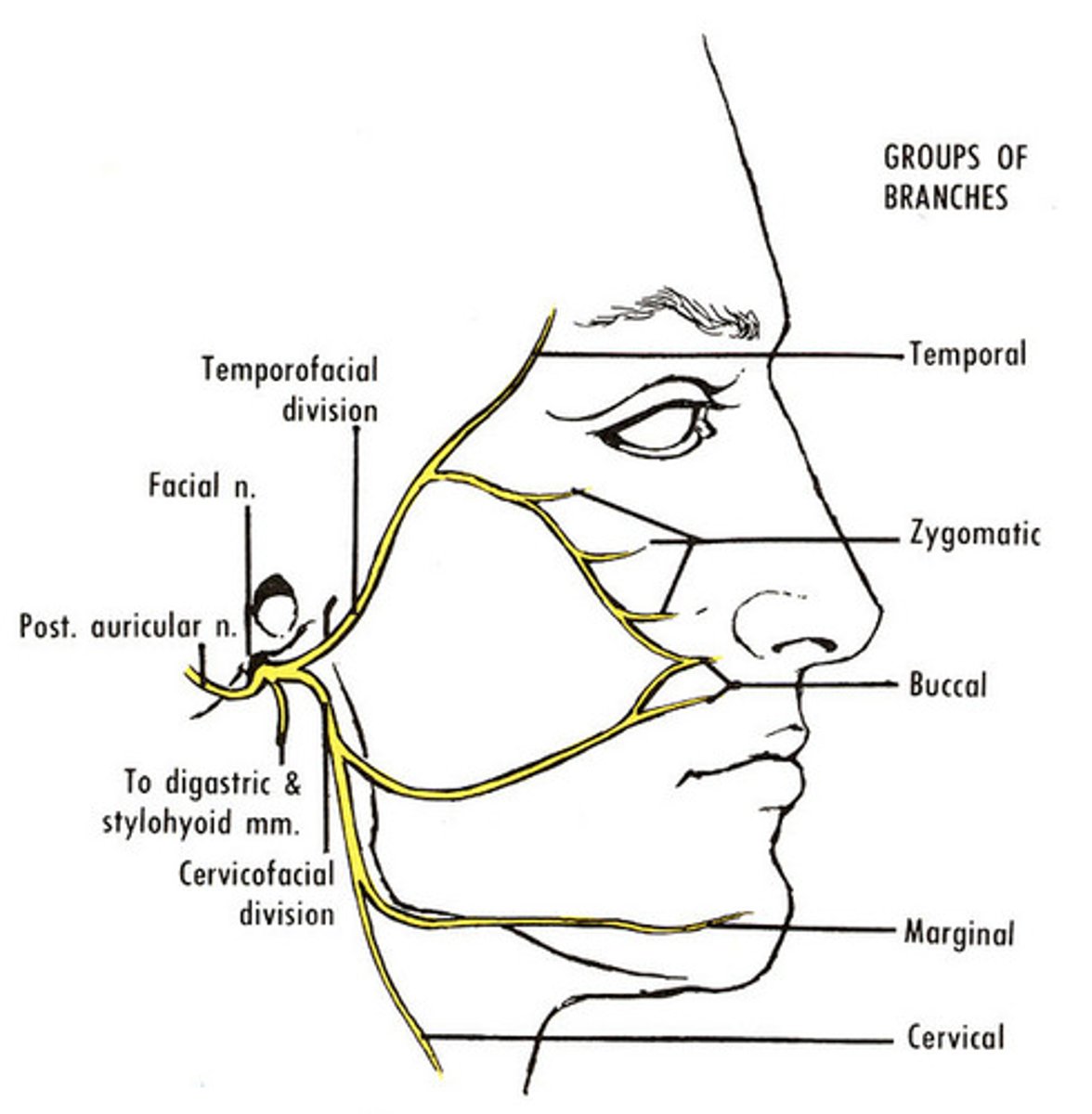 <p>What is the course and type of CN VII?</p>