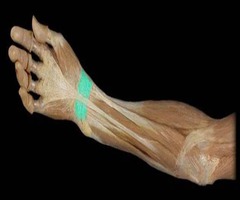 <p>Floor: arch of the carpal bones</p><p>Roof: flexor retinaculum</p>