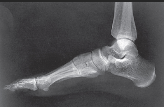 <p>On which side should the patient be positioned?</p>