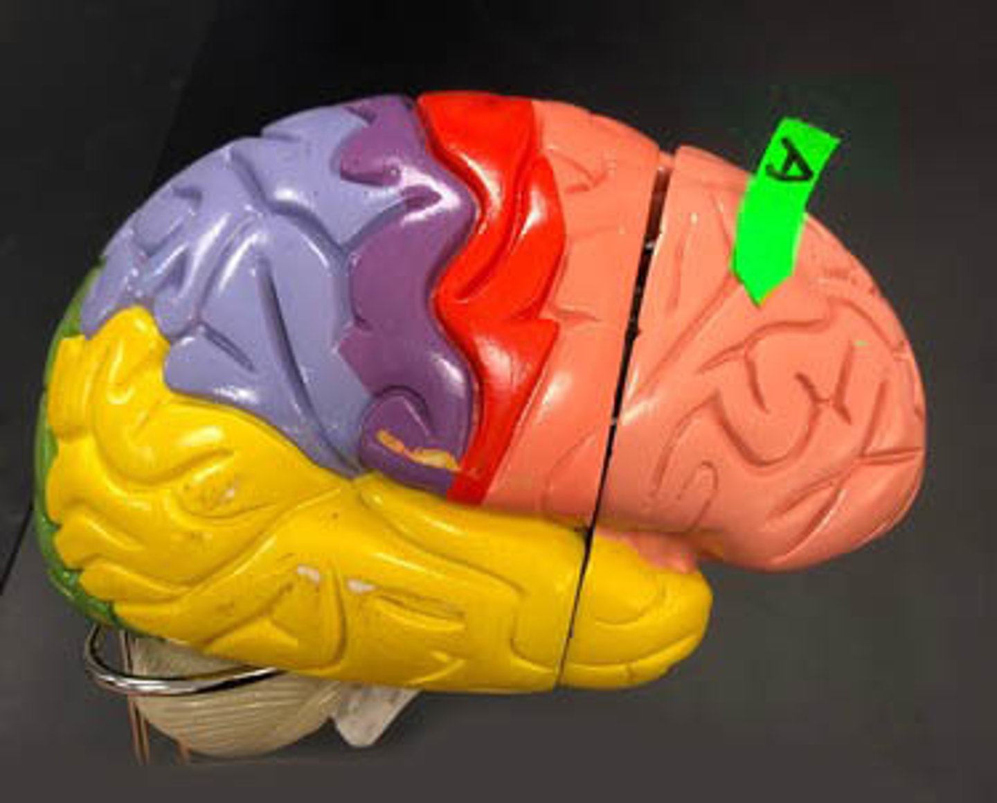 <p>Identify this lobe.</p>